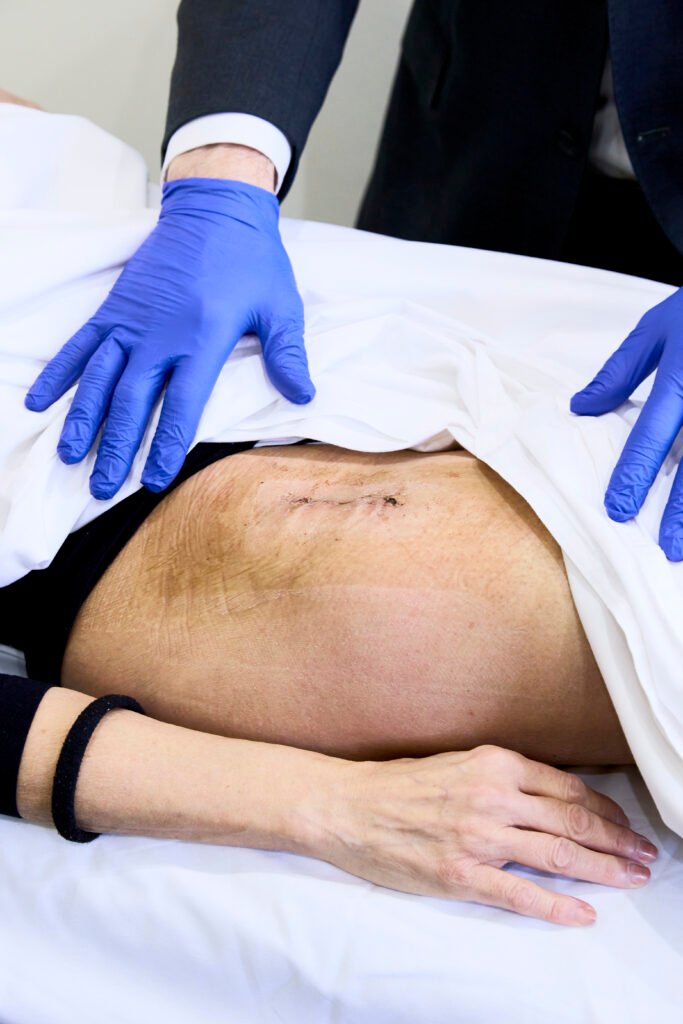 Failed Hip Replacement 250716 drjasonhockings 2m9a9363