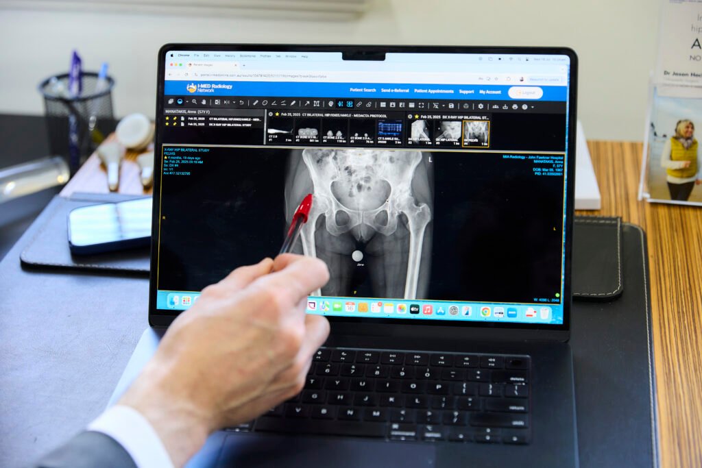 Kinematic Alignment Total Knee Replacement 250716 drjasonhockings 2m9a9637